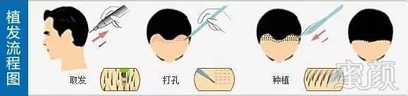 https://img.miyanlife.com/mnt/timg/181124/12495913B-1.jpg