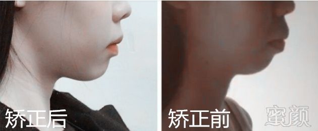 https://img.miyanlife.com/mnt/timg/181124/12501A217-2.jpg