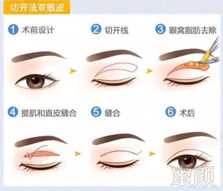 https://img.miyanlife.com/mnt/timg/181124/125329E05-2.jpg