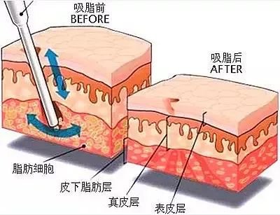 https://img.miyanlife.com/mnt/timg/181124/12532a037-3.jpg