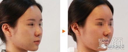 https://img.miyanlife.com/mnt/timg/181124/125354K17-0.jpg