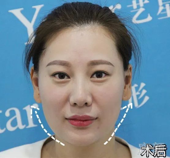 https://img.miyanlife.com/mnt/timg/181124/125F31U1-10.jpg