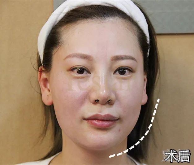 https://img.miyanlife.com/mnt/timg/181124/125F34C3-9.jpg