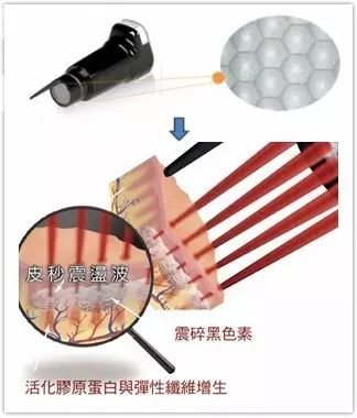 https://img.miyanlife.com/mnt/timg/181124/1301541260-10.jpg