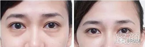 https://img.miyanlife.com/mnt/timg/181125/1021213D8-8.jpg