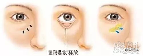 https://img.miyanlife.com/mnt/timg/181125/102121K18-11.jpg