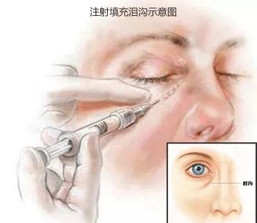 https://img.miyanlife.com/mnt/timg/181125/10253Q508-7.jpg