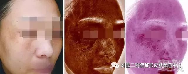 https://img.miyanlife.com/mnt/timg/181125/10415KE1-3.jpg