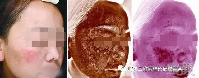 https://img.miyanlife.com/mnt/timg/181125/10415KP8-1.jpg