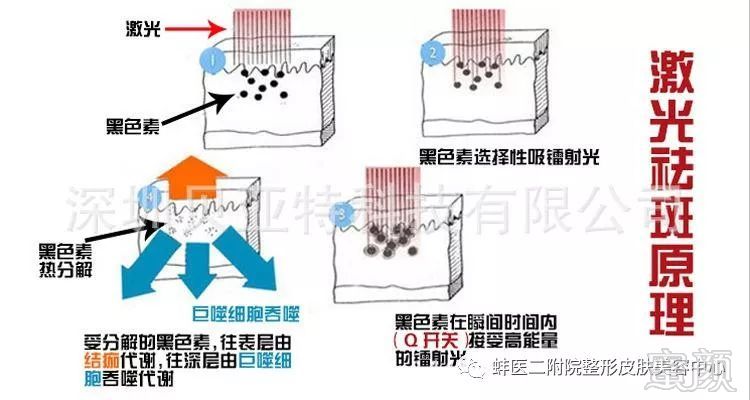 https://img.miyanlife.com/mnt/timg/181125/10415M319-5.jpg