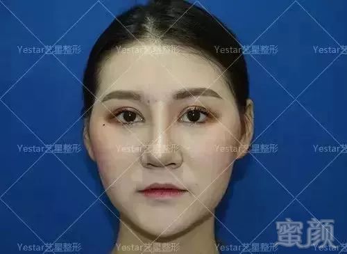https://img.miyanlife.com/mnt/timg/181125/10464J048-4.jpg