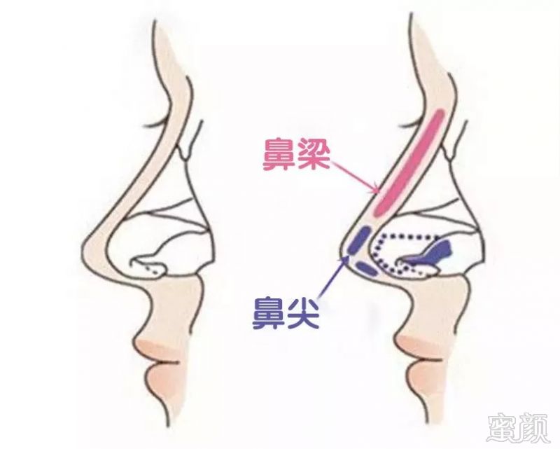 案例图片