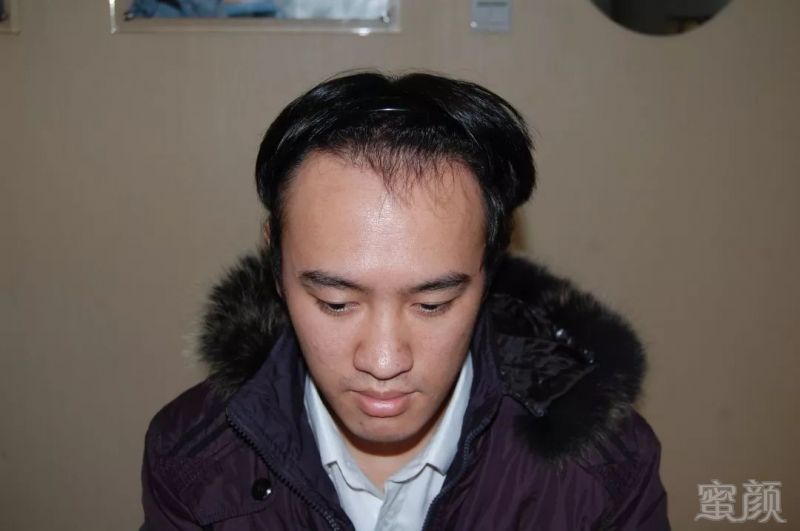 https://img.miyanlife.com/mnt/timg/181125/1122102532-1.jpg