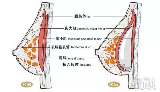 案例图片