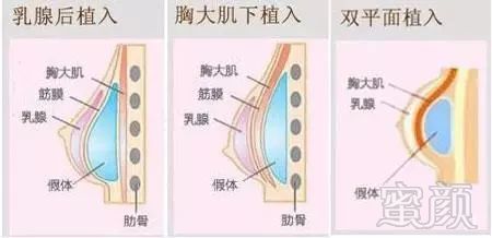 案例图片