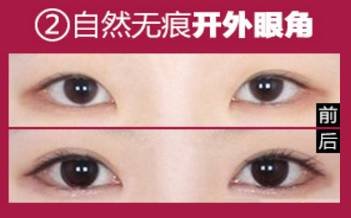 https://img.miyanlife.com/mnt/timg/181125/1206044501-2.jpg