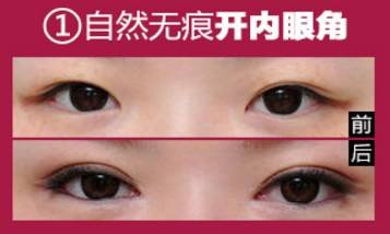 https://img.miyanlife.com/mnt/timg/181125/1206044R2-1.jpg