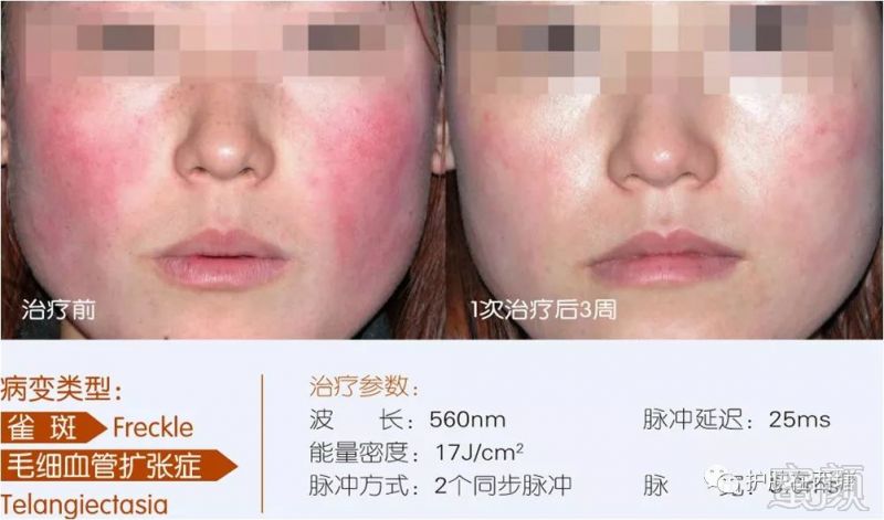 https://img.miyanlife.com/mnt/timg/181125/12142HH8-3.jpg