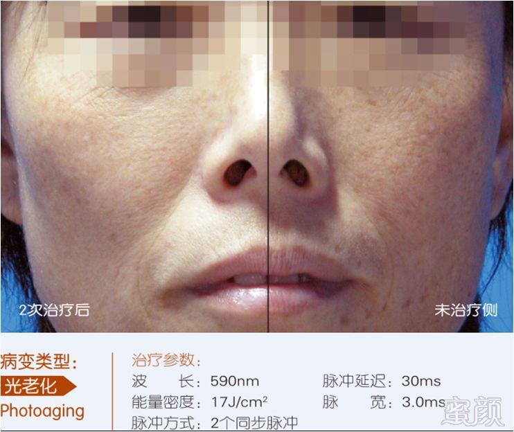 https://img.miyanlife.com/mnt/timg/181125/12142I520-5.jpg
