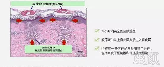 https://img.miyanlife.com/mnt/timg/181125/121QA950-2.jpg