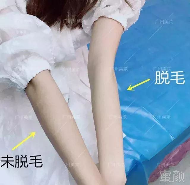 https://img.miyanlife.com/mnt/timg/181126/1040464309-5.jpg