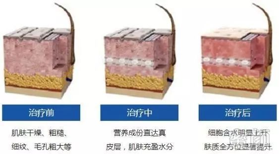https://img.miyanlife.com/mnt/timg/181126/105FH251-12.jpg