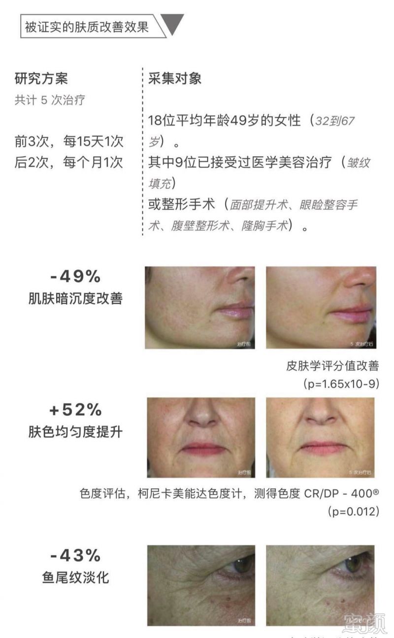 https://img.miyanlife.com/mnt/timg/181126/105FKc6-9.jpg