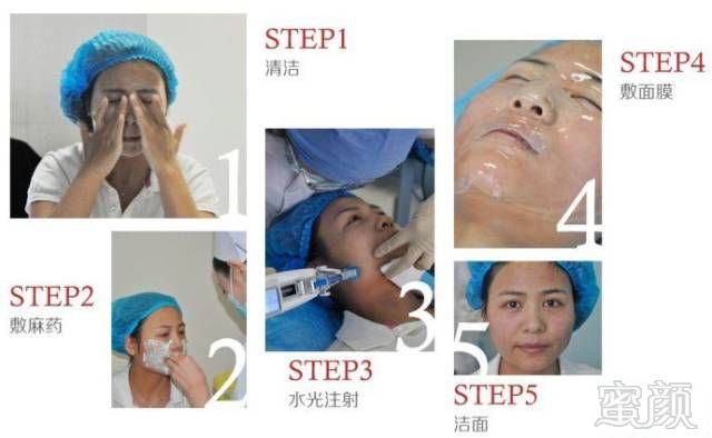 https://img.miyanlife.com/mnt/timg/181126/105FW125-15.jpg