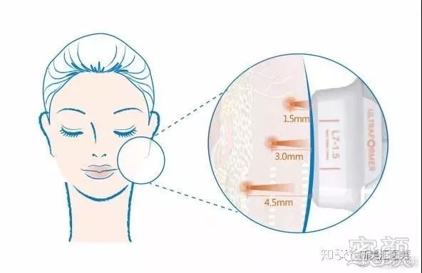 https://img.miyanlife.com/mnt/timg/181126/105Z3OM-1.jpg