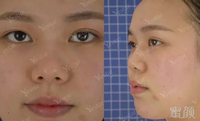 https://img.miyanlife.com/mnt/timg/181126/110Q634Y-5.jpg