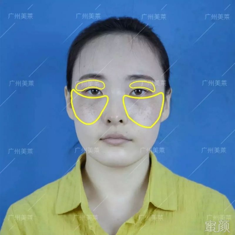 https://img.miyanlife.com/mnt/timg/181126/12025034V-0.jpg