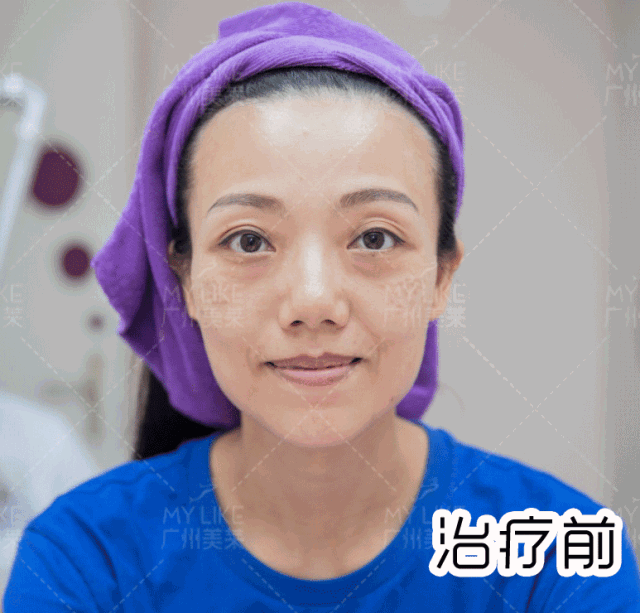 https://img.miyanlife.com/mnt/timg/181126/1202535354-3.jpg