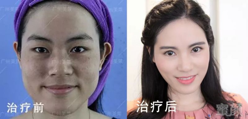 https://img.miyanlife.com/mnt/timg/181126/1202543610-9.jpg