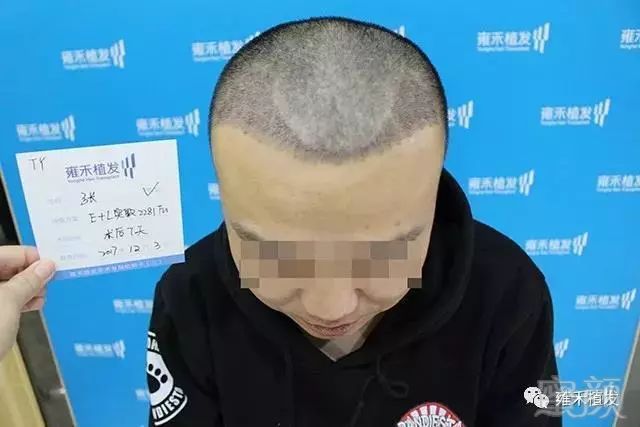 https://img.miyanlife.com/mnt/timg/181126/1214431O4-6.jpg