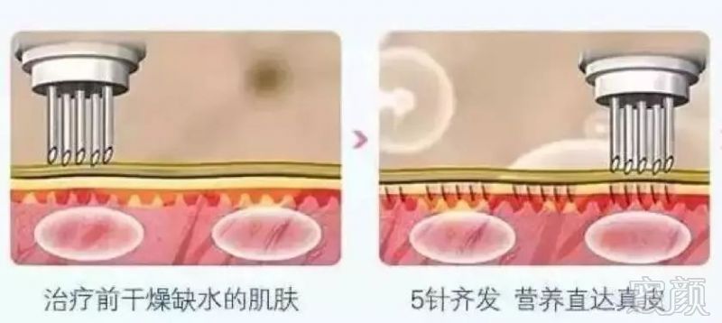 https://img.miyanlife.com/mnt/timg/181126/122F22935-7.jpg