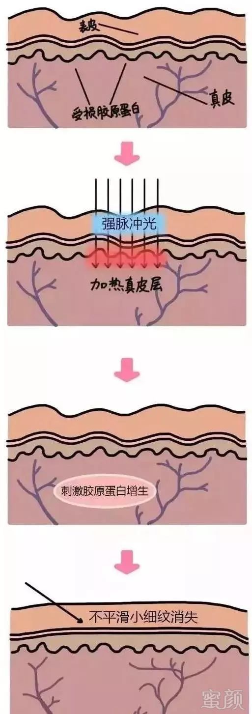 https://img.miyanlife.com/mnt/timg/181126/122F2N39-6.jpg