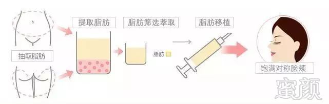 https://img.miyanlife.com/mnt/timg/181126/124PL9E-6.jpg