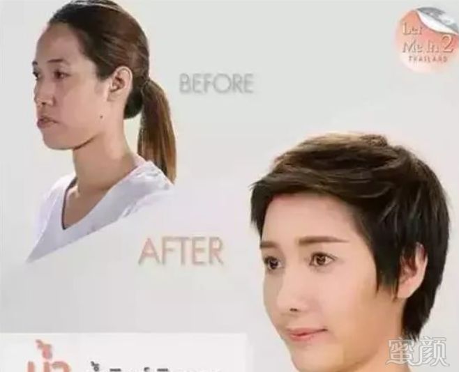 https://img.miyanlife.com/mnt/timg/181127/110UL1b-4.jpg