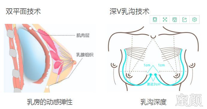 案例图片