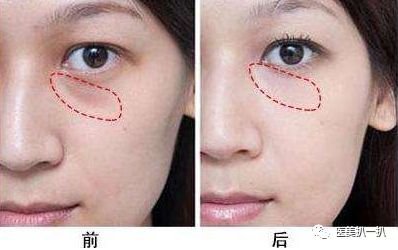 https://img.miyanlife.com/mnt/timg/181127/120K43T2-2.jpg