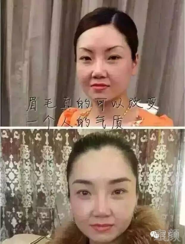 案例图片