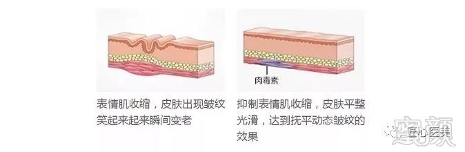 https://img.miyanlife.com/mnt/timg/181127/12301a555-3.jpg