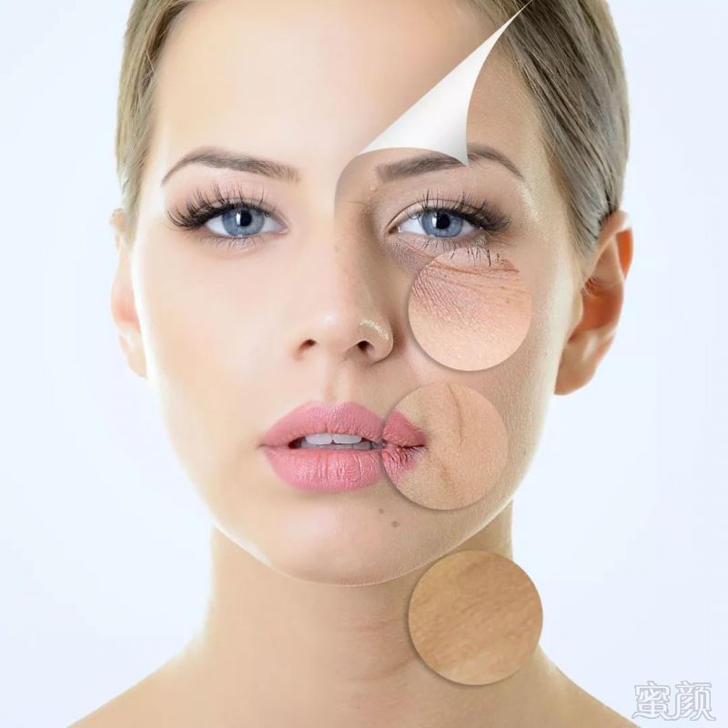 https://img.miyanlife.com/mnt/timg/181127/1234402B9-0.jpg