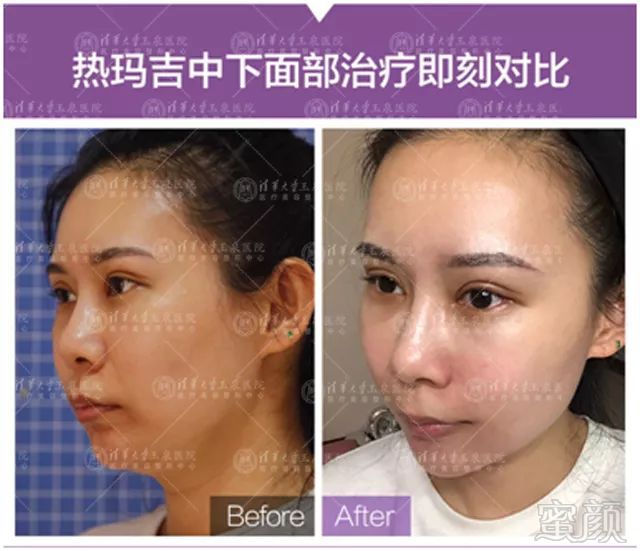 https://img.miyanlife.com/mnt/timg/181127/12350T537-5.jpg
