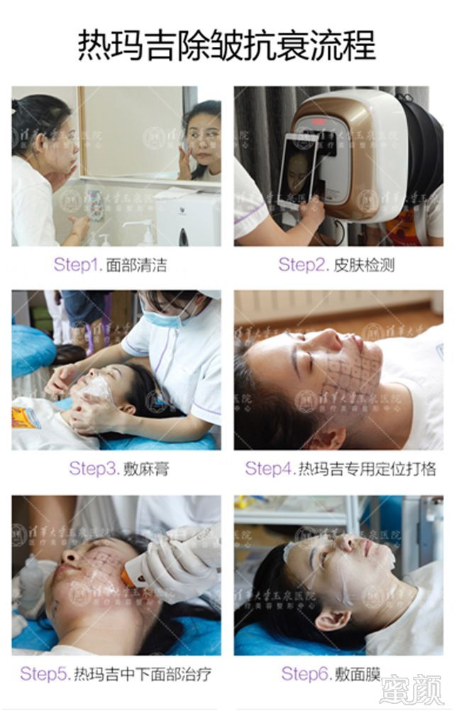 https://img.miyanlife.com/mnt/timg/181127/12350VR6-4.jpg