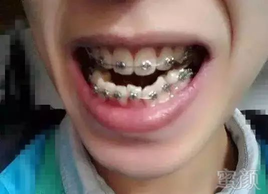 https://img.miyanlife.com/mnt/timg/181127/1240563c0-4.jpg