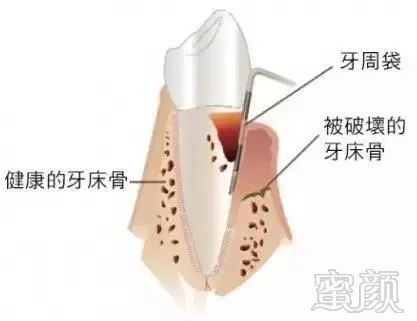 案例图片