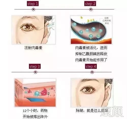 https://img.miyanlife.com/mnt/timg/181128/113I96244-3.jpg