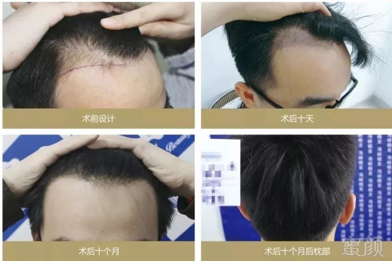 https://img.miyanlife.com/mnt/timg/181128/11515L511-4.jpg