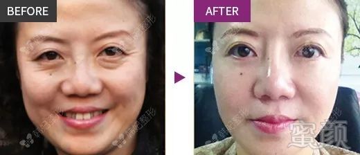 https://img.miyanlife.com/mnt/timg/181128/12125932P-9.jpg